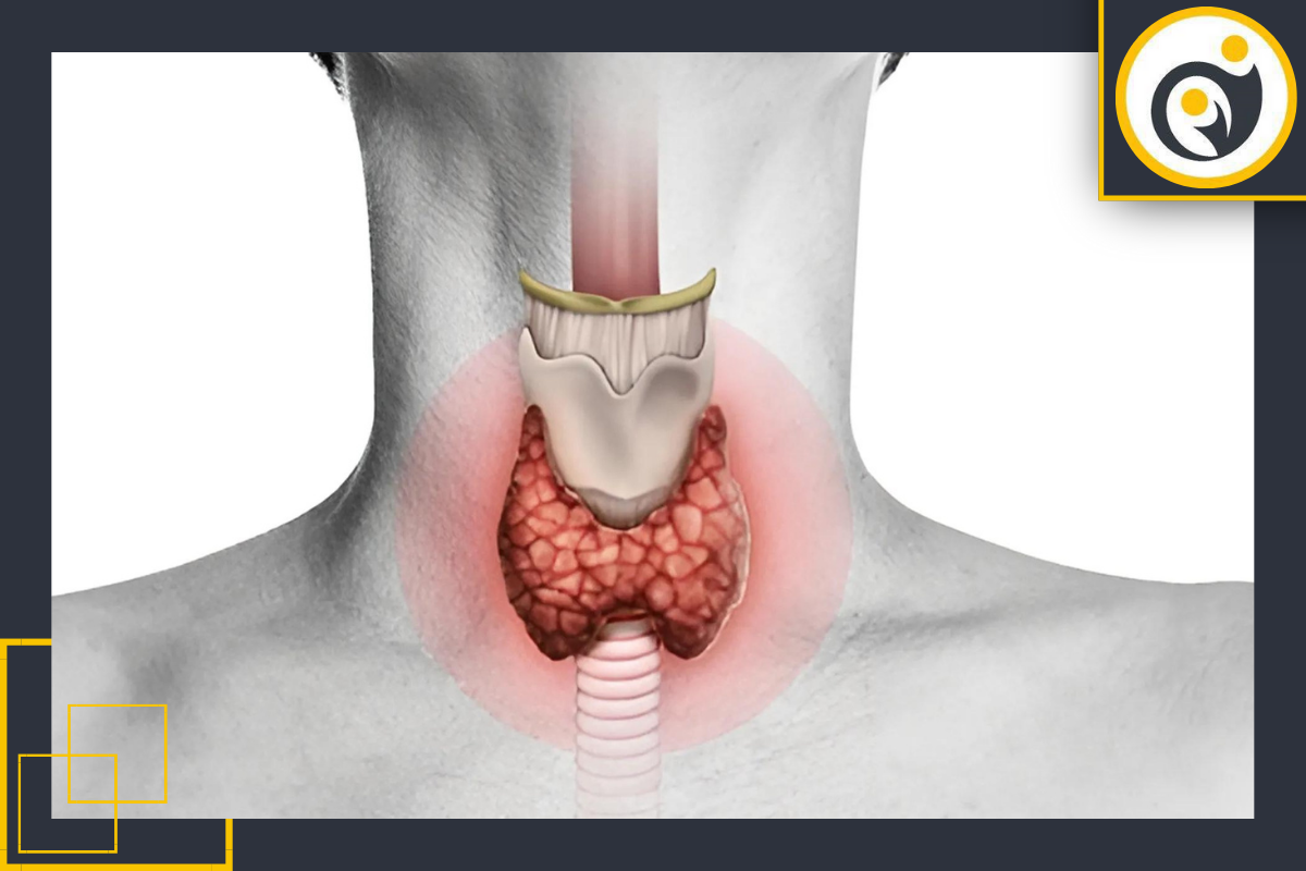 نمونه‌برداری تیروئید چیست؟