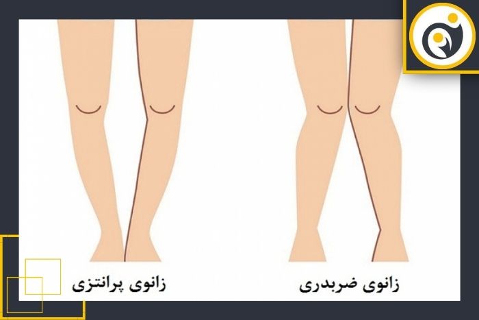 چه کسانی به تصویر برداری استخوانی نیاز دارند؟