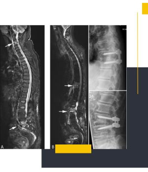 تکنولوژی تصویربرداری Full Spine