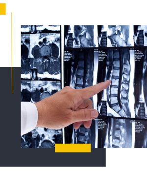 فرآیند انجام تصویربرداری جامع ستون مهره‌ها