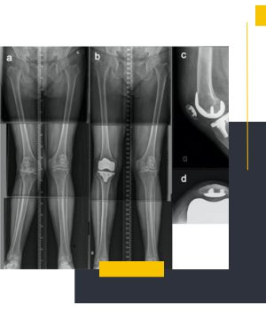 زمان نیاز به رادیوگرافی Alignment View زمان نیاز به رادیوگرافی Alignment View
