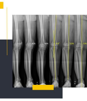 دلیل ایستاده بودن در رادیوگرافی محور اندامها دلیل ایستاده بودن در رادیوگرافی محور اندامها