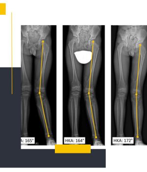 الایمنت ویو برای چه سنی مناسب است؟ الایمنت ویو برای چه سنی مناسب است؟