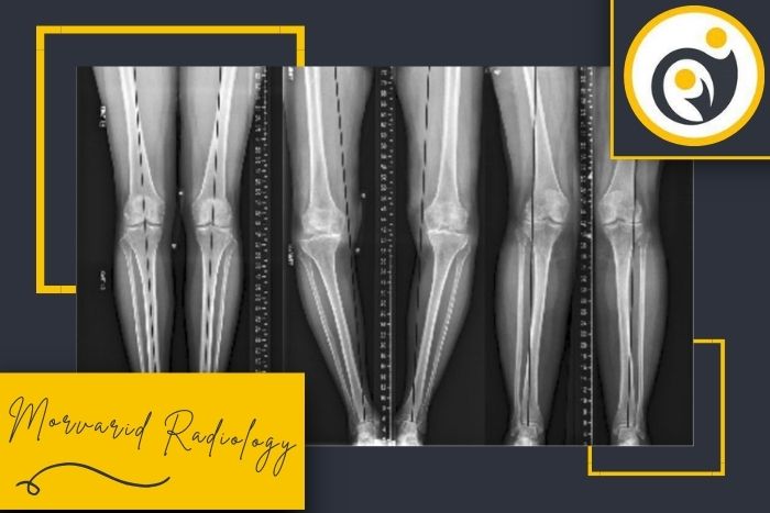 رادیوگرافی الایمنت ویو در شهرری و جنوب تهران با دقیق ترین تشخیص رادیوگرافی الایمنت ویو در شهرری و جنوب تهران با دقیق ترین تشخیص