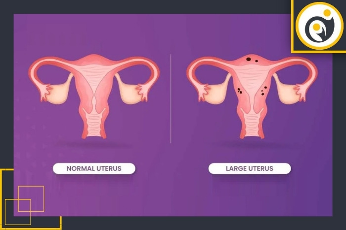 سایر روشهای تشخیص سایر روشهای تشخیص