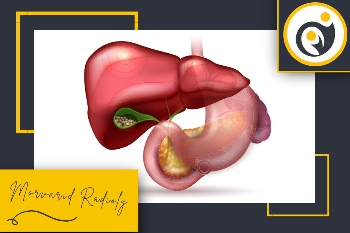 آیا سونوگرافی شکم برای تشخیص سنگ صفرا کافی است؟ آیا سونوگرافی شکم برای تشخیص سنگ صفرا کافی است؟