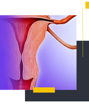 عوارض احتمالی روش تصویربرداری داخل رحمی