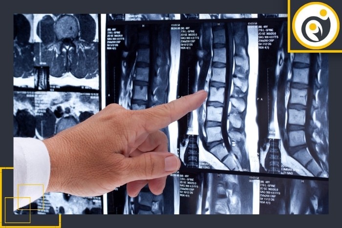 بهترین روش‌های تصویربرداری بعد از عمل