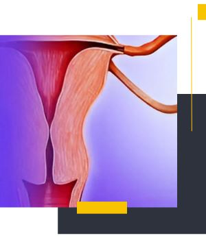 عوارض احتمالی روش تصویربرداری داخل رحمی
