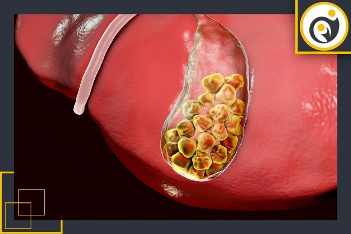 چه زمانی باید از روش‌های تکمیلی استفاده کرد؟