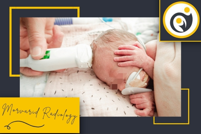 تفاوت بین سونوگرافی مغزی نوزادان نارس با بقیه نوزادان در چیست؟