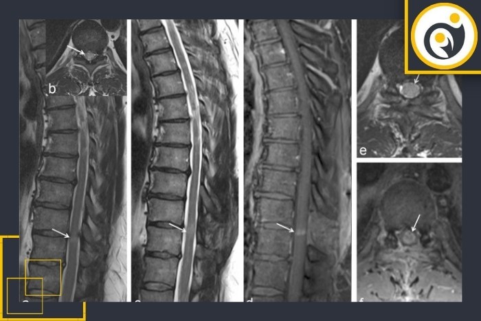 تفاوت تصویربرداری قبل و بعد از عمل