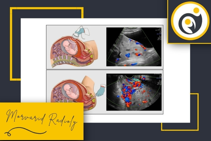 تفاوت سونوگرافی ترانس واژینال و شکمی در اوایل حاملگی چیست؟