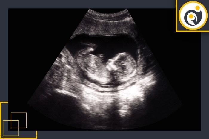 تفاوت سونوگرافی ترانس واژینال و شکمی در اوایل حاملگی تفاوت سونوگرافی ترانس واژینال و شکمی در اوایل حاملگی