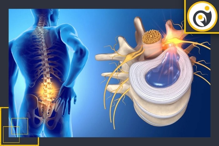 توصیه‌های پایانی بعد از جراحی برای بیماران