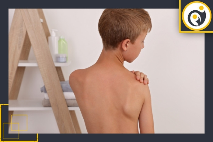 راهکارهای پیشگیری از قوز کمر