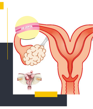 موارد استفاده از هیستروگرافی