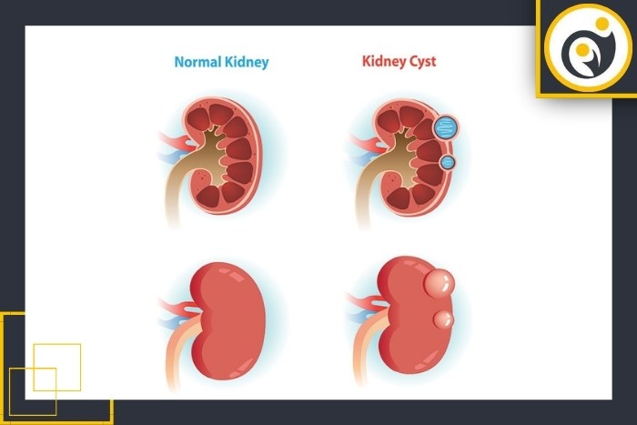 روش‌های تشخیص و شناسایی