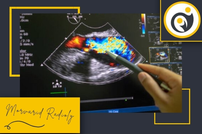 سونوگرافی رنگی چگونه به تشخیص بیماری‌های قلبی کمک می‌کند؟