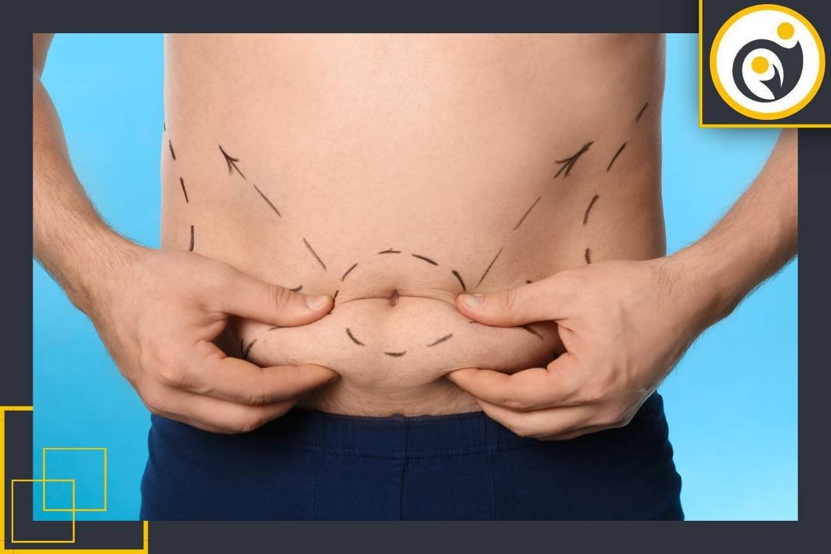 چه کسانی به سونوگرافی پیش از عمل ابدومینوپلاستی نیاز دارند؟