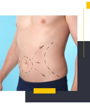 سونوگرافی چگونه به پزشک پیش از عمل ابدومینوپلاستی کمک می‌کند؟