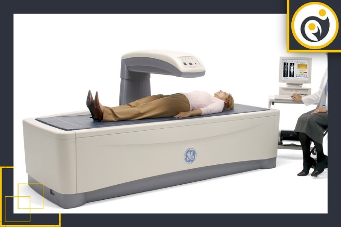 عدد پوکی استخوان در سنجش تراکم استخوان عدد پوکی استخوان در سنجش تراکم استخوان