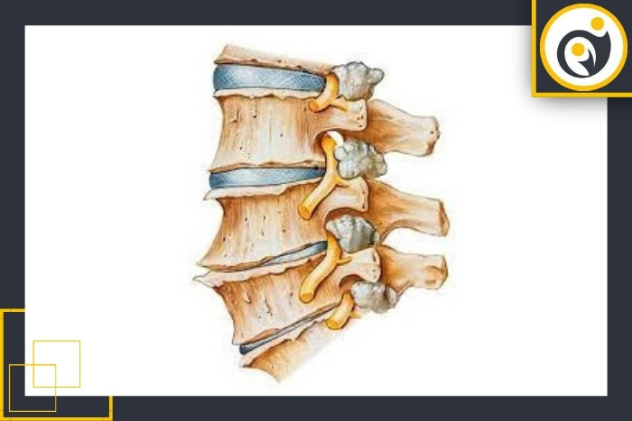علائم و نشانه‌ها