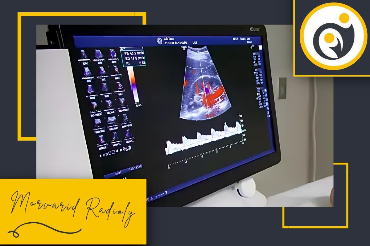 بهترین مرکز سونوگرافی کالر داپلر در شهر ری | مروارید ری