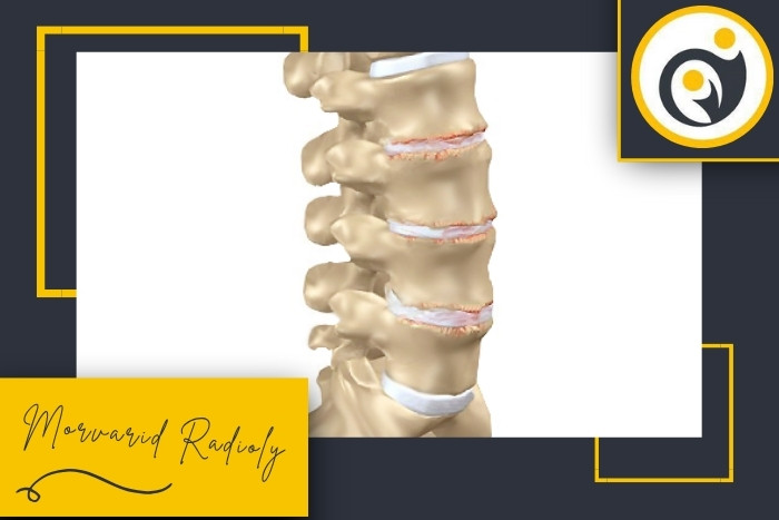 چه زمانی باید علائم غیرعادی در حالت نشستن یا ایستادن را جدی گرفت؟
